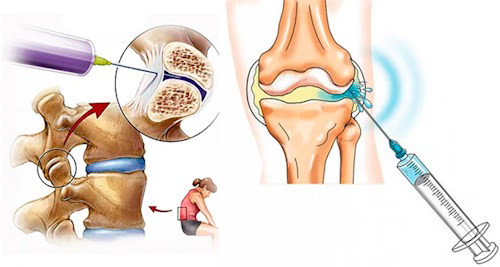 Поверхностная блокада