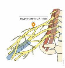 N. suprascapularis (передний и задний доступы)